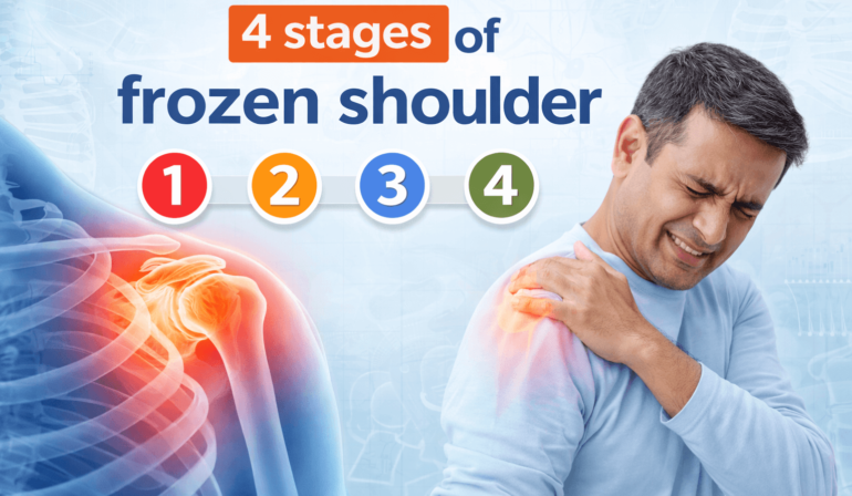 4 Stages of Frozen Shoulder: Symptoms & Expert Recovery